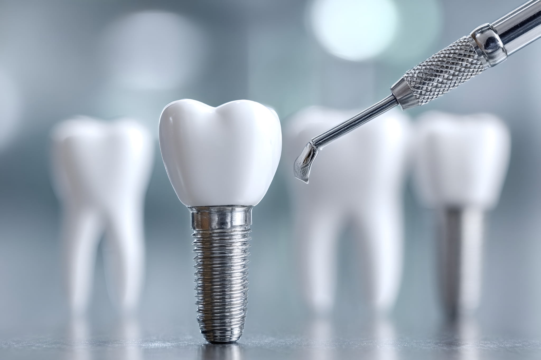 インプラント治療のイメージ