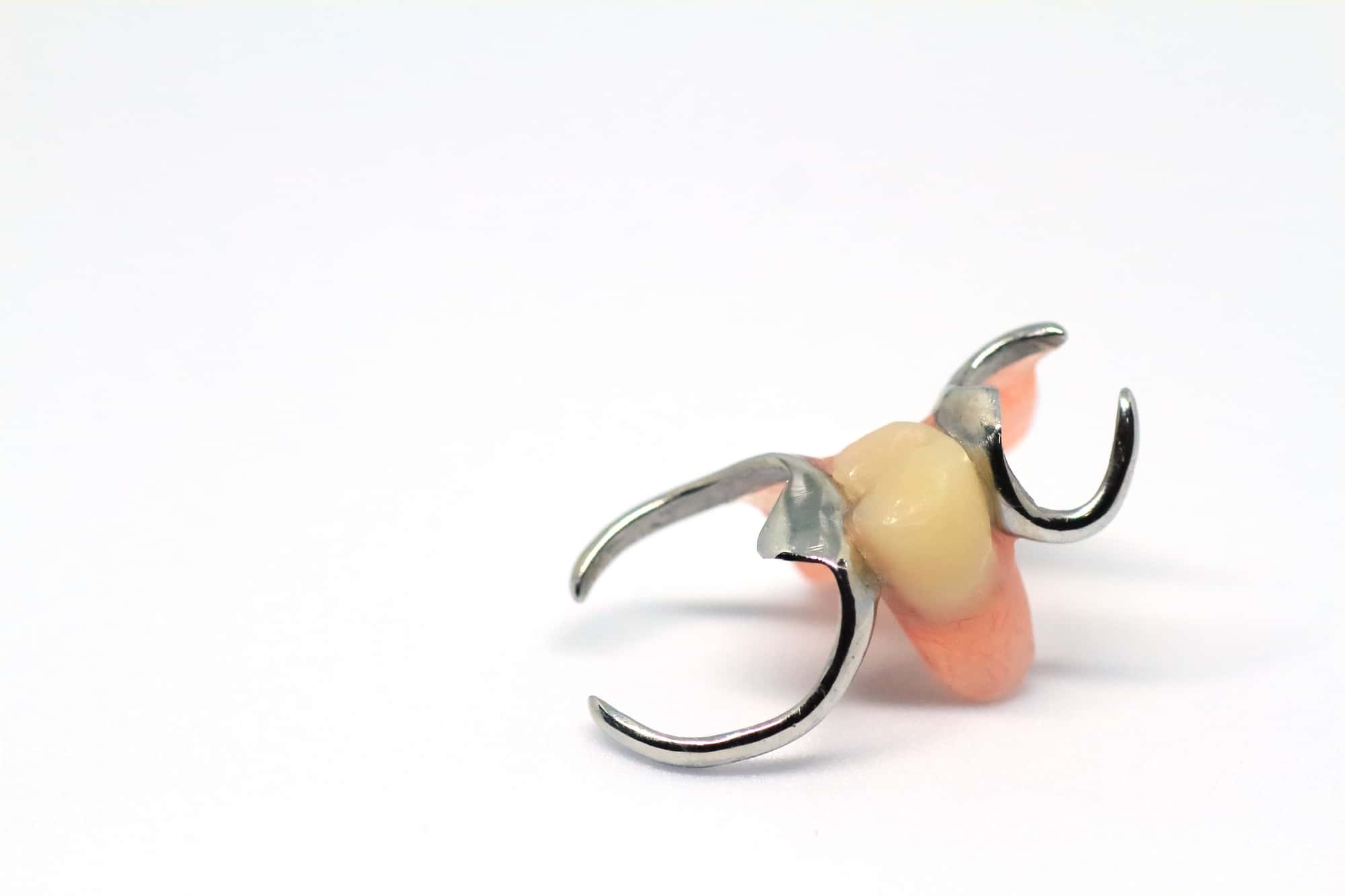 部分入れ歯のイメージ