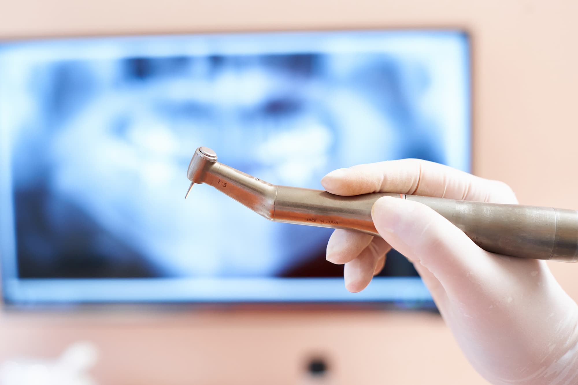 バーを使用する歯科医師の手元 